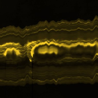 Dijital ekran aksaklık etkisi doku soyut. sarı ve siyah
