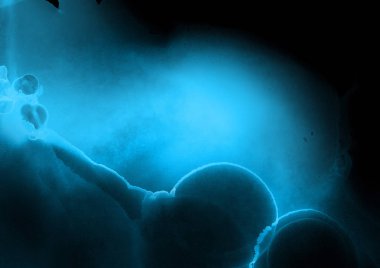 mavi mürekkep deseni lekeler, soyut arkaplan