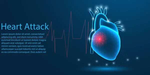 Órgão médico de ataque cardíaco humano. baixo conceito de tema wireframe poli no fundo azul. Vetor de ilustração . — Vetor de Stock