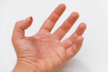 Parmağında yara. Başparmak Kızıl kanıyla. Merhem-tedavi parmak bir kesim sonra. Sağ el bir yara var. Boğaz parmak.