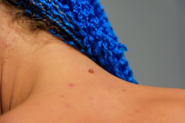 Mavi uzun Zi-Zi pigtails. Örgü dokuma tekniği. Deri. Bir kulak. Vücuttaki benler. Kanser eğitim. Afrokosichki Afrika örgü örgü. Saç modeli.