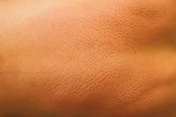 Tappetino Massaggi Schiena Segni Sulla Pelle Dal Massaggiatore Mat Applicatore — Foto Stock