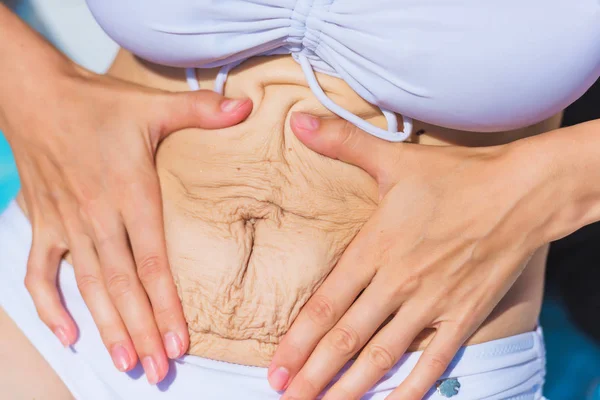 Girl White Swimsuit Holds Her Hands Her Stomach Stretched Skin Royalty Free Stock Photos