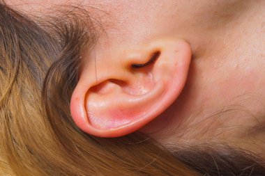 Kadın kulakları çekim. Kulakların iltihaplı derisi. Akne ve siyah noktalar ile auricle kızlar.