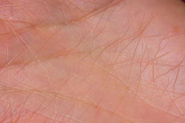 Textúra Bőr Tenyér Papilloma Vírus Kezét Kezdeti Szakaszban Életvonalak Kéznél — Stock Fotó