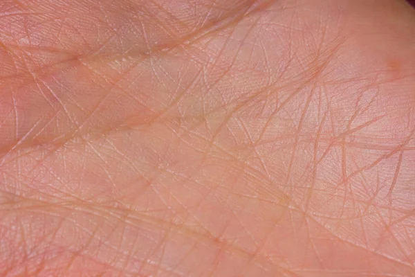 The texture of the skin of the palms. Papilloma virus on hands in the initial stage. Life lines on hand. — Stock Image Texture Skin Palms Papilloma Virus Hands Initial Stage Life Lines Royalty Free Stock Photos