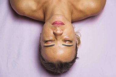 Gözlerinden estetik ameliyat geçirmiş bir kadın. Göz kapaklarında kanama sonrası dikişler var. Göz ve göz fıtığının altındaki torbaların çıkarılmasından hemen sonra yüzünün durumu..