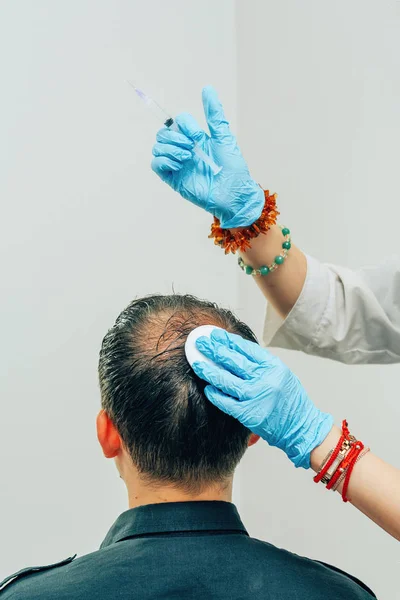 Mesotherapy of hair and head. Injections in the head. Male pattern baldness. Fighting hair loss in men. Men\'s bald spot in the center of the head at the crown. The hands of the cosmetologist the doctor of the trichologist and the head of the patient