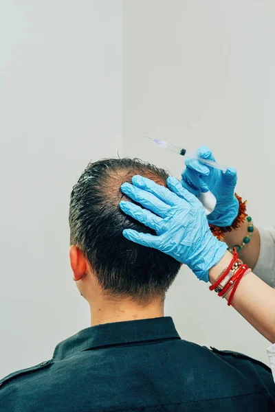 Mesotherapy of hair and head. Injections in the head. Male pattern baldness. Fighting hair loss in men. Men\'s bald spot in the center of the head at the crown. The hands of the cosmetologist the doctor of the trichologist and the head of the patient