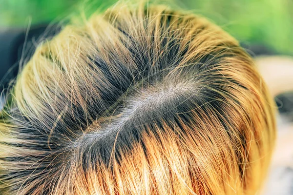 The texture of the hair on the girl\'s head. Black roots in bleached hair. The hair parting on the head.