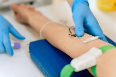 Kadınlarda kanın biyokimyasal analizi. Genç bir kız için HIV testi. Test için damardan alınan kan örneği. Doktorun ofisindeki kadın