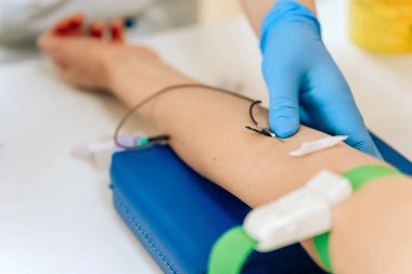 Kadınlarda kanın biyokimyasal analizi. Genç bir kız için HIV testi. Test için damardan alınan kan örneği. Doktorun ofisindeki kadın