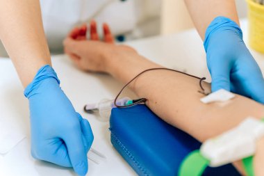 Kadınlarda kanın biyokimyasal analizi. Genç bir kız için HIV testi. Test için damardan alınan kan örneği. Doktorun ofisindeki kadın