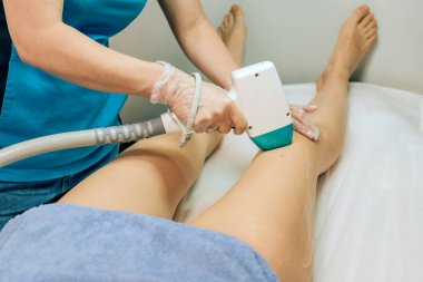 Lazer epilasyon kızlar. Bir kadının bacaklarında epilasyon. Bir lazer ile saç köklerinin tahrip. Radikal bir epilasyon yöntemi. Ofis güzellik lazer radyasyonkullanımı