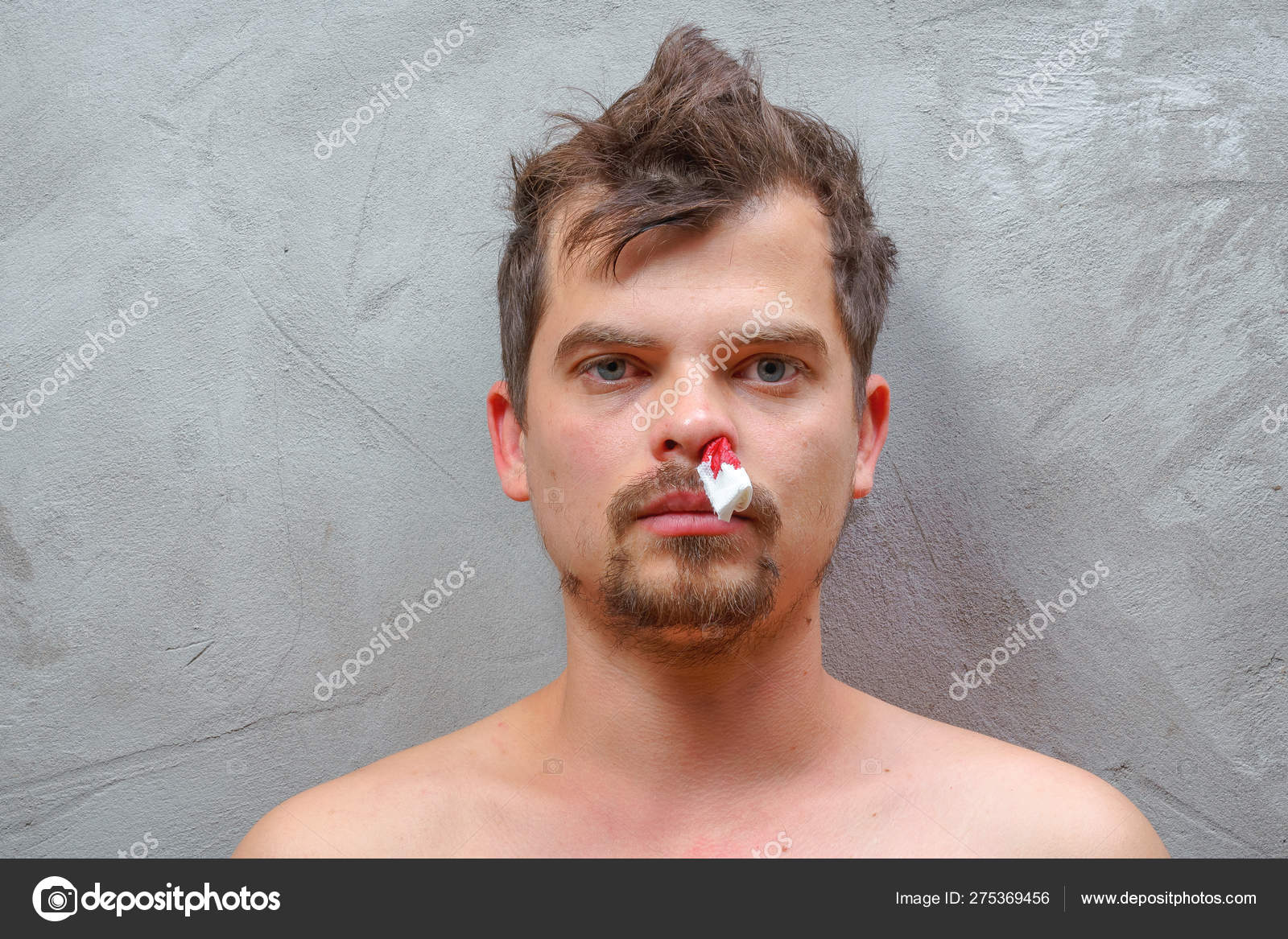 Bleeding Nose Young Guy Blood Pressure Men White Napkin Man