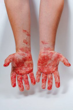 Beyaz bir arka planda kanlar içinde. İnsan derisinde kırmızı kan var. Kirli eller