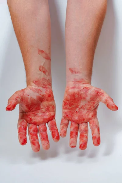 배경에 혈액에 사람의 인간의 피부에 더러운 — 스톡 사진