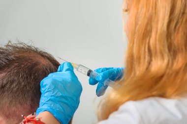 Kafa derisinin mezoterapisi. Erkek tipi kellik. Adamın kafasında kel. Doktor bir adamın kafasına ateş ediyor..