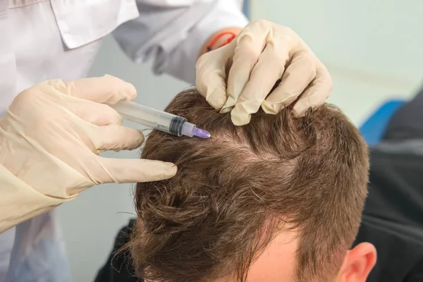 Mesotherapy of the scalp. Male pattern baldness. Bald on the man\'s head. The doctor makes a shot in the head of a man.