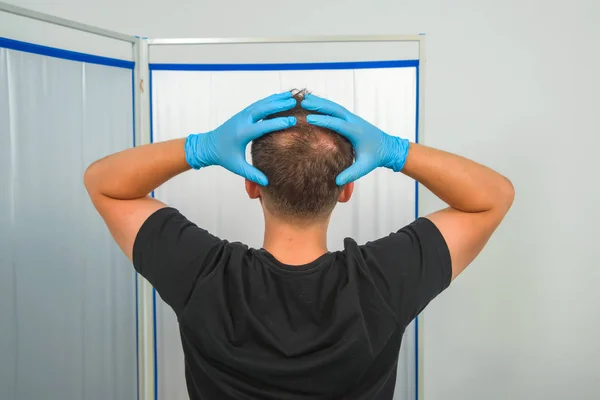 Guy in blue latex holding his head. Male pattern baldness. Mesotherapy of the scalp. Bald on the man\'s head.
