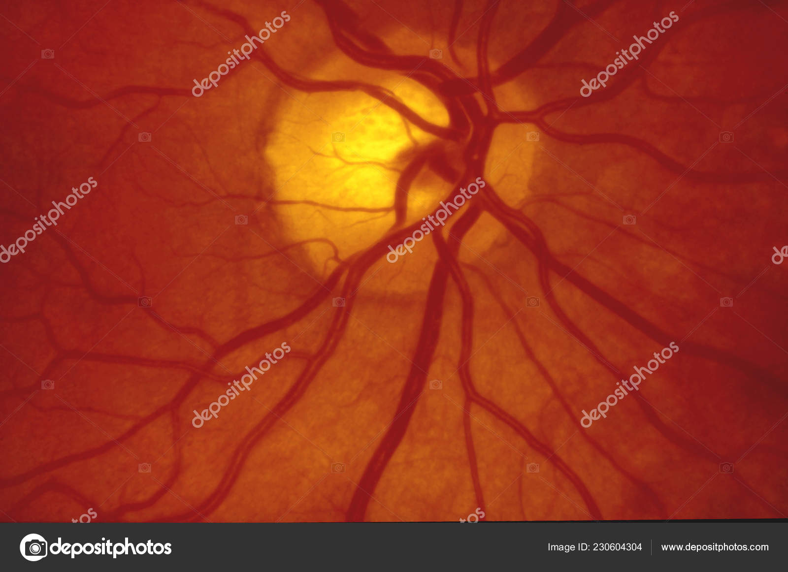 Fundus Photography Back Eye Normal Human Retina Stock Photo by