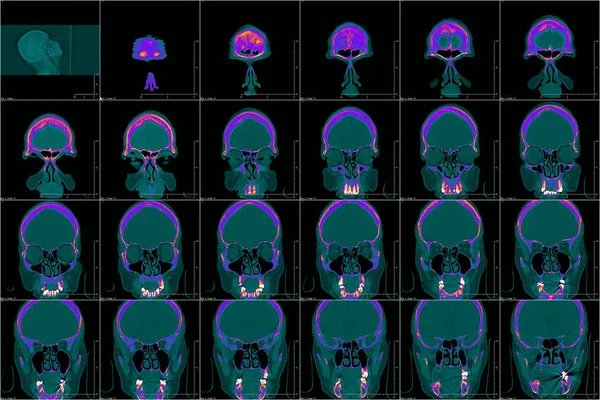 Голова Комп Ютерній Томографії Кольорове Зображення — стокове фото
