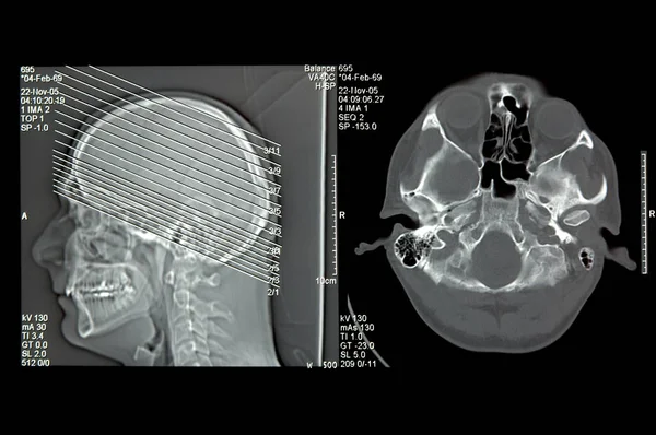 CT head image — Stock Photo, Image