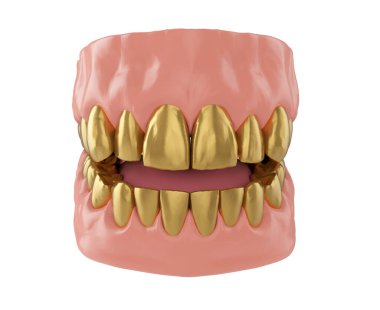 Çenedeki metal altın dişler, dişlerdeki altın kaplama, 3D.