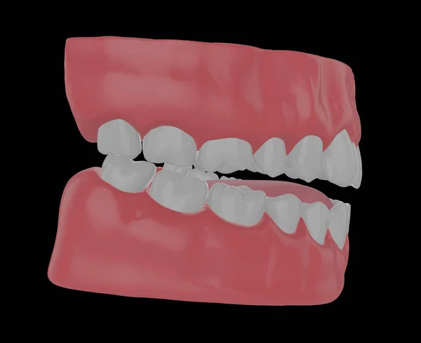 Mandíbula Humana Con Dientes Rectos Mordida Correcta Render — Foto de Stock