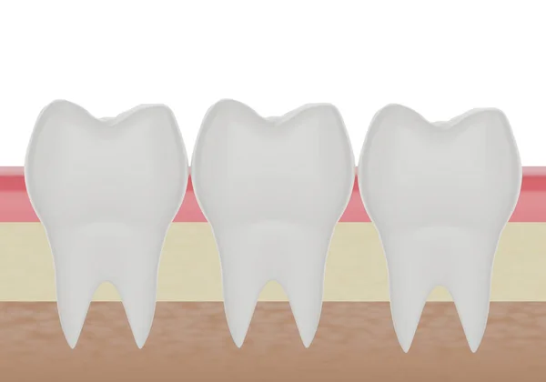 Trois Dents Molaires Propres Dans Gencive Rendu — Photo