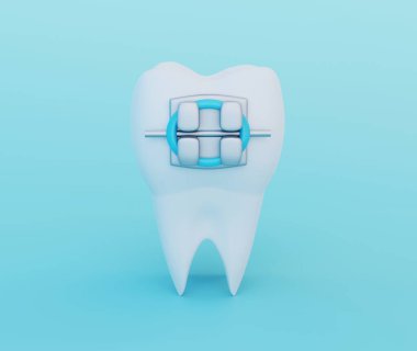 Mavi arka planda metal diş telleri olan bir diş. Dikkat, Ortodonti ve Diş Hekimliği sembolleri, 3B oluşturma