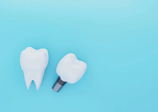 Tooth Crown and Tooth Implant on blue background with copy space, artificial tooth, 3d render