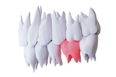 Ağrıyan dişli insan dişi, kırmızı alttaki azı dişi, beyaz, yan görünüşte izole edilmiş, 3 boyutlu.