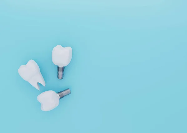 Tooth Crown and Tooth Implants on blue background with copy space, artificial teeth, 3d render