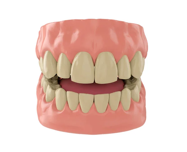 Lidská Čelist Žlutými Zuby Izolované Bílém Vykreslení — Stock fotografie