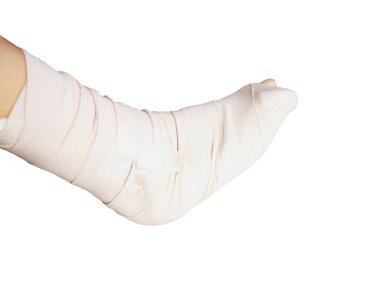 Kırık bacak ve tedavi için yumuşak atel.