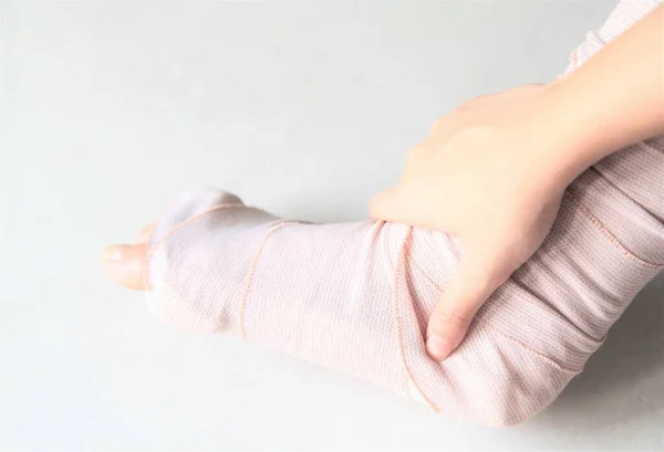 Kırık Bacağı Tedavi Için Yumuşak Bir Kırık Tahtası Olan Hasta — Stok fotoğraf
