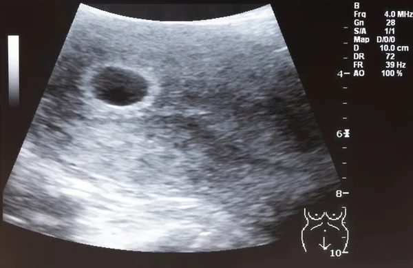 Ultrasound Bayi Pada Wanita Hamil — Stok Foto