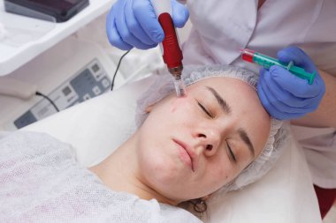 Deri altına serum girişi ile mezotari süreci