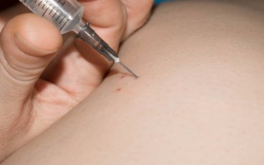 prick intramuscular injection with an antibiotic syringe into the buttock of a person for medicine clipart