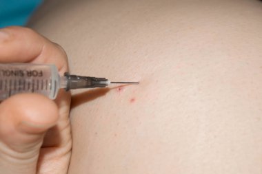 kas içi enjeksiyon ile antibiyotik bir şırınga ilaç için bir kişi kalça içine pislik