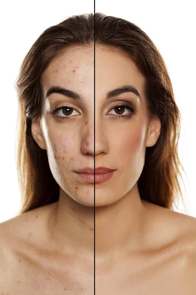 Retrato Comparação Mesma Mulher Antes Depois Tratamento Cosmético Maquiagem Fundo — Fotografia de Stock