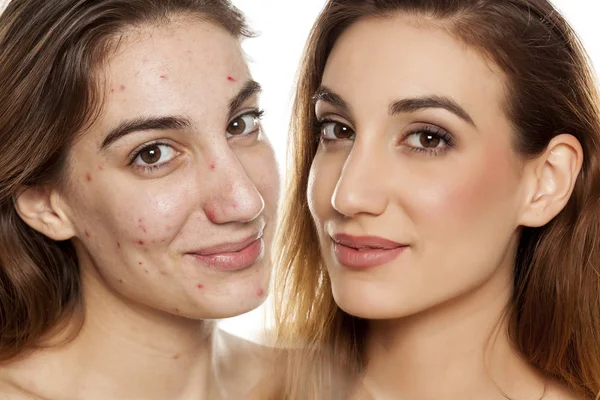 Retrato Comparação Mesma Mulher Antes Depois Tratamento Cosmético Maquiagem Fundo — Fotografia de Stock