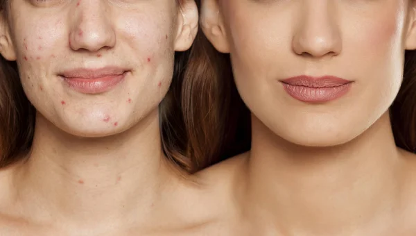 Retrato Comparação Mesma Mulher Antes Depois Tratamento Cosmético Maquiagem Fundo — Fotografia de Stock
