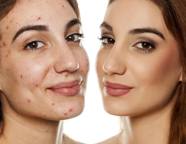 Retrato Comparação Mesma Mulher Antes Depois Tratamento Cosmético Maquiagem Fundo — Fotografia de Stock