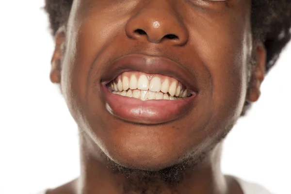 Close Jovem Afro Americano Bonito Mostrando Seus Dentes Fundo Branco — Fotografia de Stock