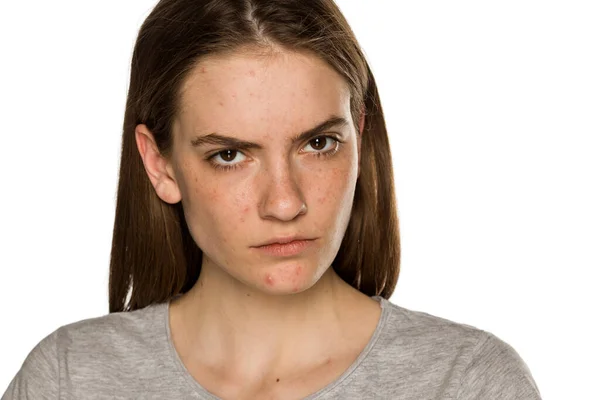 Joven Mujer Seria Pecosa Sin Maquillaje Sobre Fondo Blanco — Foto de Stock