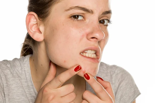 Young Woman Squeezing Her Pimples White Background — Stock Photo, Image