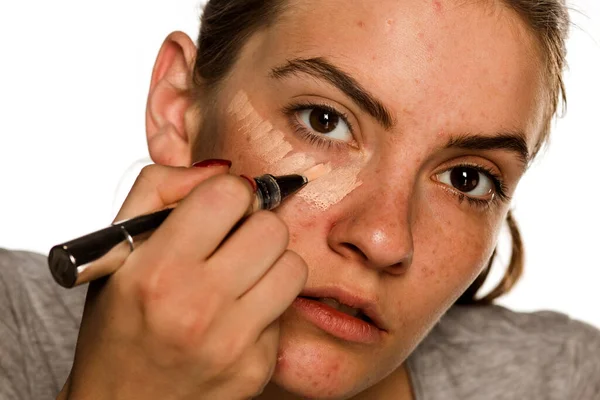 Young Woman Problematic Ckin Applying Concealer White Background — Stock Photo, Image