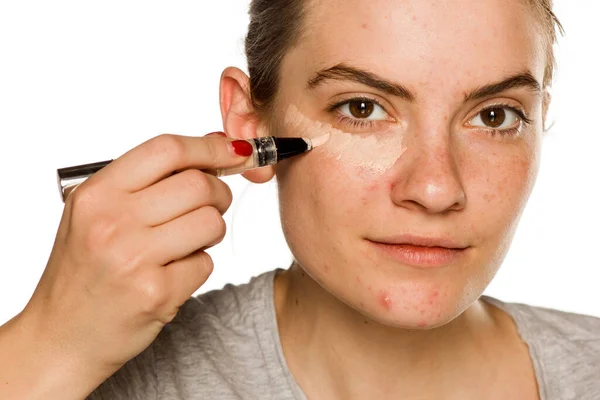 Young Woman Problematic Ckin Applying Concealer White Background — Stock Photo, Image